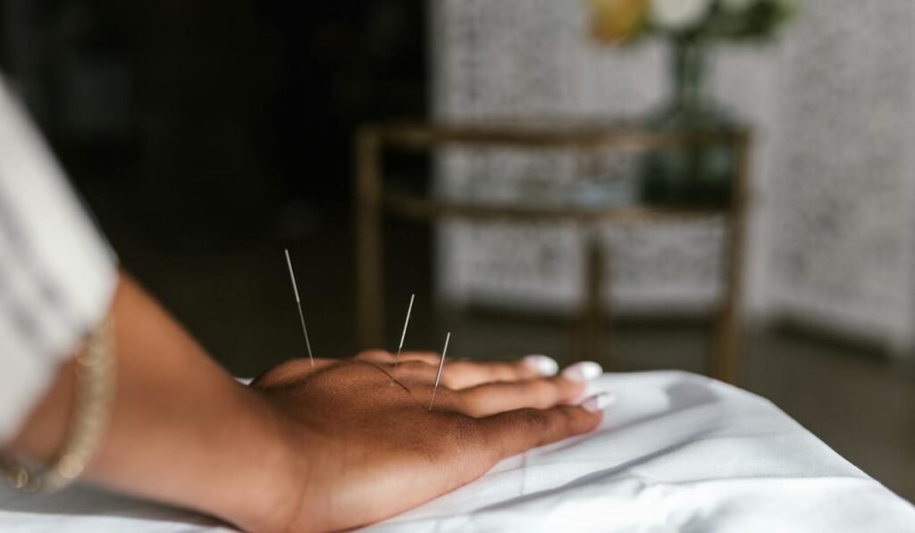 A women having acupuncture treatment at Manhattan acupuncture clinic