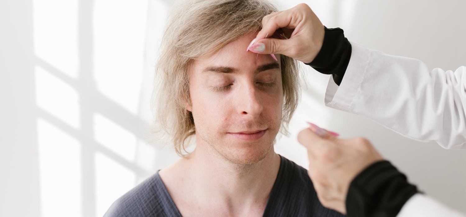 An adult male receiving cosmetic acupuncture treatment in manhattan