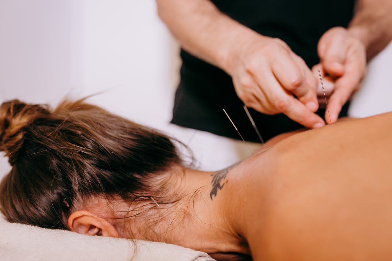 A woman receiving acupuncture therapy, with a practitioner inserting needle on back